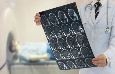 Apa Itu Radiologi dan Fungsinya untuk Kesehatan?