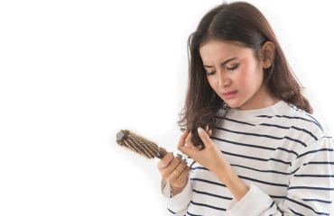 rambut botak di usia muda