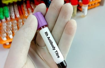 Titer Antibodi Covid-19: Pengertian dan Fungsinya