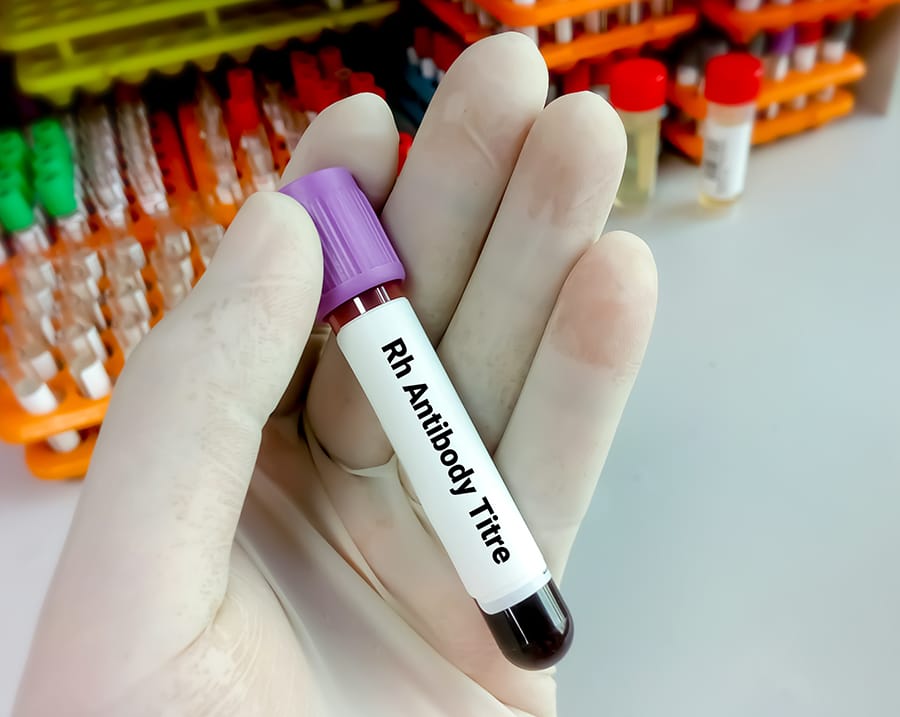 Titer Antibodi Covid-19