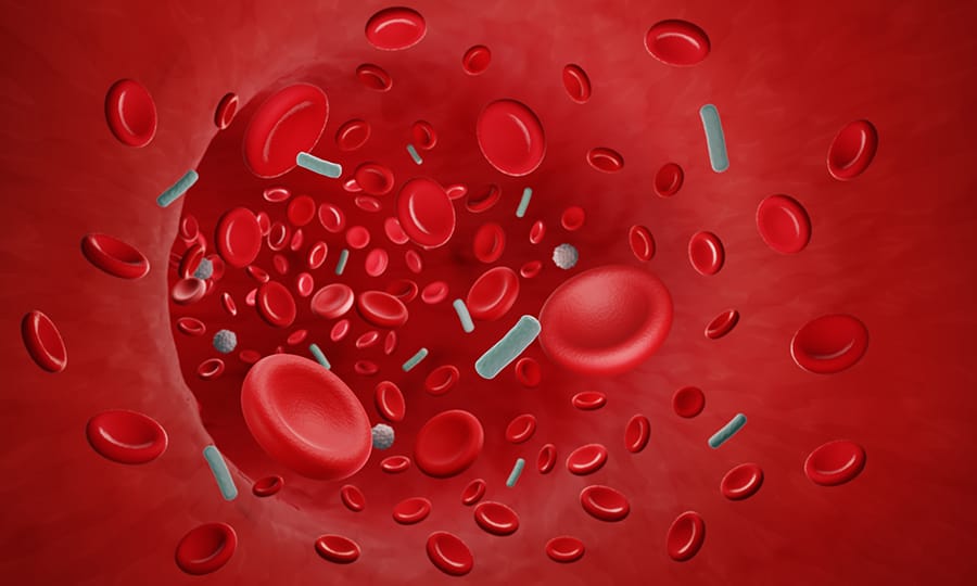 Apa Itu Bakteremia? Begini Penjelasannya!