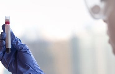 Tanda-Tanda Trombosit Turun