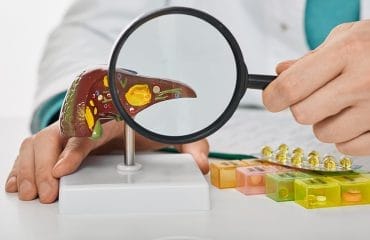 Perawatan Hepatitis B