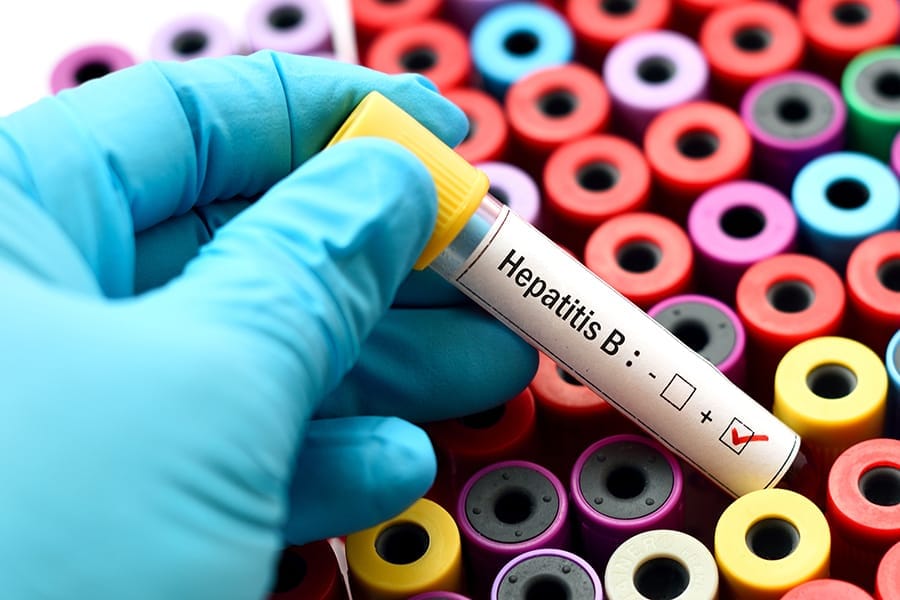 Cara Penularan Hepatitis B