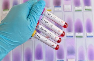 Bagaimana Cara Penularan Penyakit PMS?