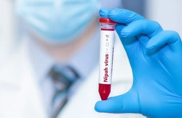 Apa Itu Virus Nipah? Penyebab, Gejala, hingga Pengobatannya
