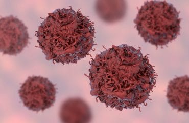 Sel Kanker: Tahapan Perkembangan, Stadium, hingga Tingkatannya