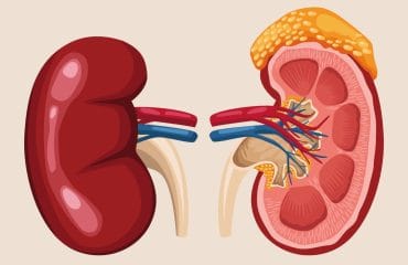 jenis penyakit ginjal