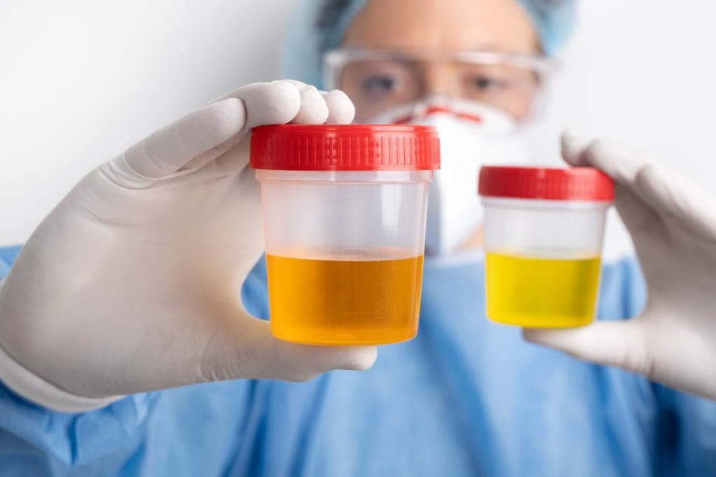 warna urine ibu hamil