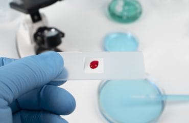 kadar trombosit normal