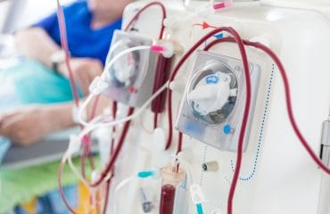 Apakah Cuci Darah Bisa Ditanggung BPJS Kesehatan?