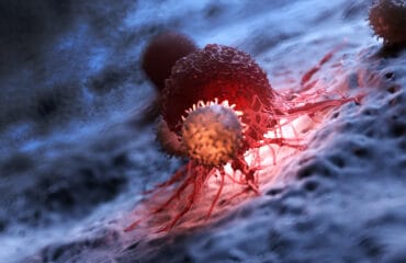 Perbedaan Tumor dan Kanker