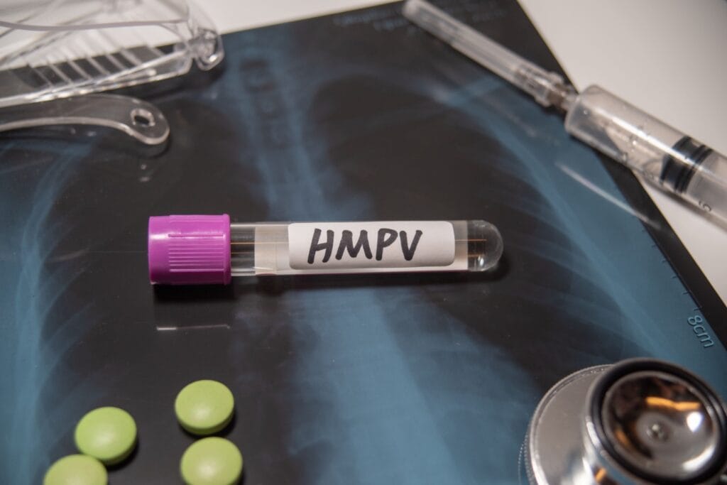 virus HMPV di Indonesia