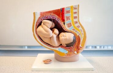 ciri-ciri janin tidak berkembang