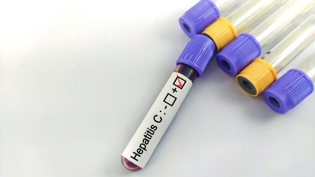 hepatitis c adalah