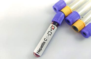 hepatitis c adalah