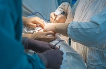 Biopsi ginjal adalah