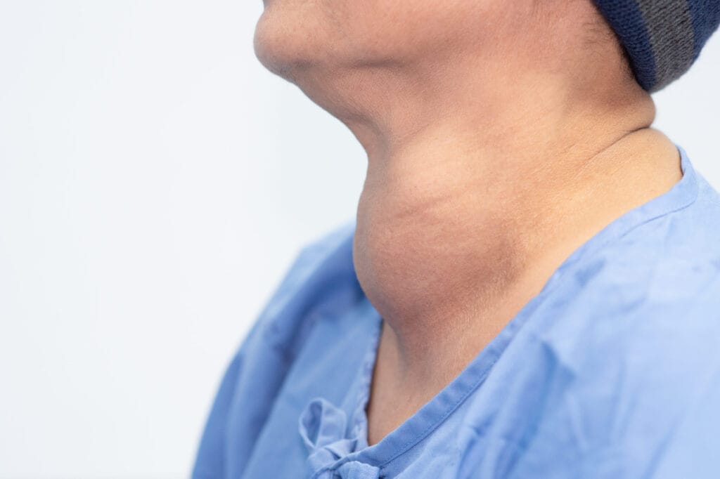 Tanda Tubuh Kelebihan Garam