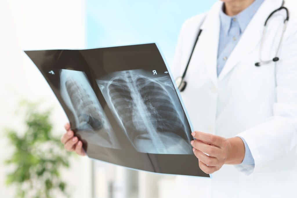 Pembengkakan jantung