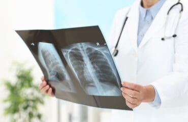 Pembengkakan jantung