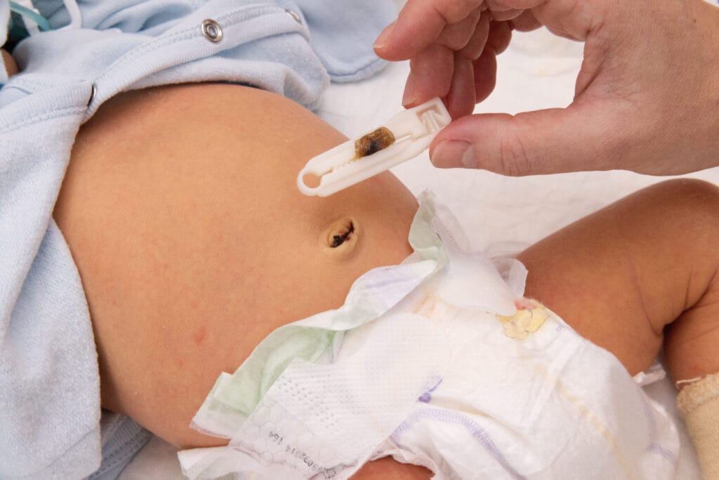 perawatan tali pusat bayi baru lahir