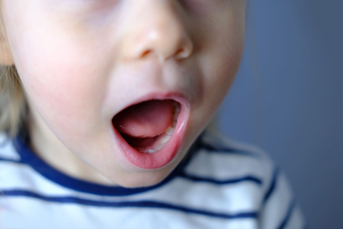 jenis gangguan bicara